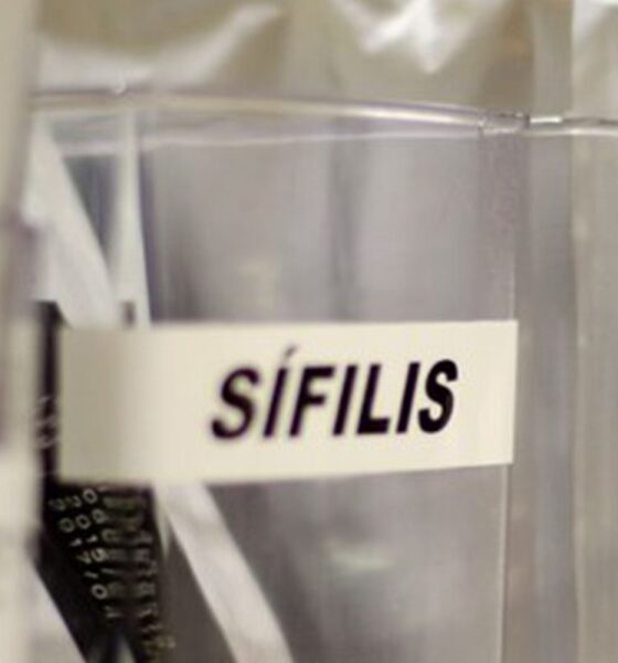 Centro de São Paulo oferece testagem gratuita para HIV, hepatite, sífilis e gonorreia