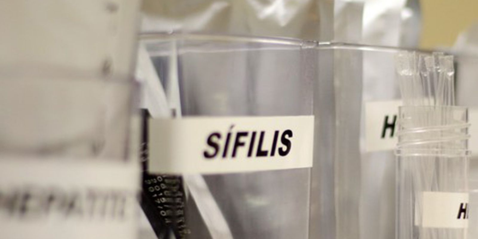 SUS implementa uso de antibiótico para prevenção de sífilis e clamídia