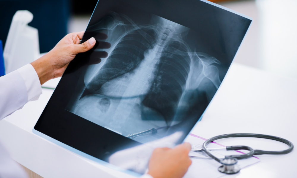 IgesDF publica edital para compra de novos aparelhos de raio-X