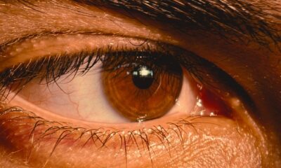 Pesquisa apoiada pela FAPDF busca explicar circulação de líquido essencial ao funcionamento do sistema ocular