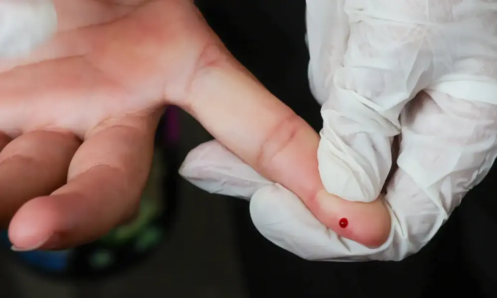 SUS inicia oferta de teste rápido para diagnóstico de dengue