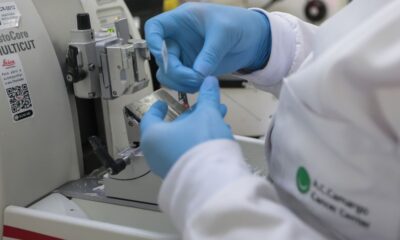 Publicada lei que amplia prevenção e controle do câncer no SUS