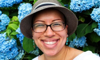 Pacientes com alopecia areata compartilham experiências para recuperar autoestima