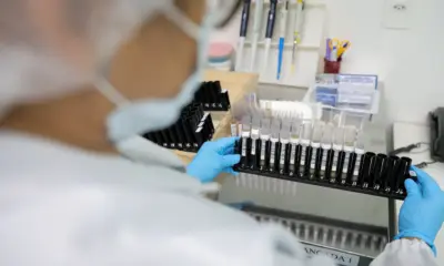 Malária: Anvisa autoriza teste em humanos de vacina 100% brasileira